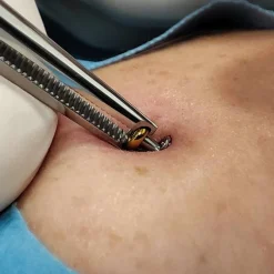 Kleszcze do piercingu - microdermal - NK-013